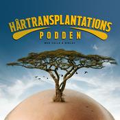 Podcast Hårtransplantations Podden