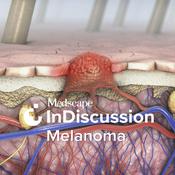 Podcast Medscape InDiscussion: Melanoma