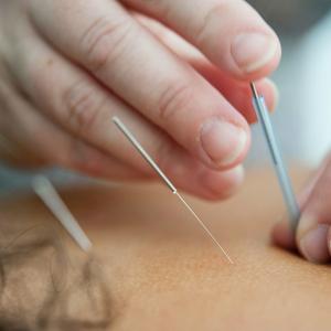 Acupuncture Wellness